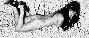 Sexo, lunares y millones: cómo transformó la locura en arte