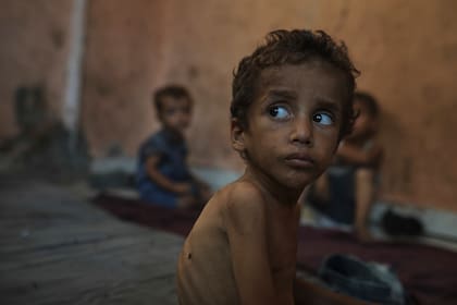 Yazan Abu Ful, un niño de 2 años que padece desnutrición, mira a su alrededor el miércoles 23 de julio de 2025 en el campamento de refugiados Shati, en Ciudad de Gaza. (AP Foto/Jehad Alshrafi)