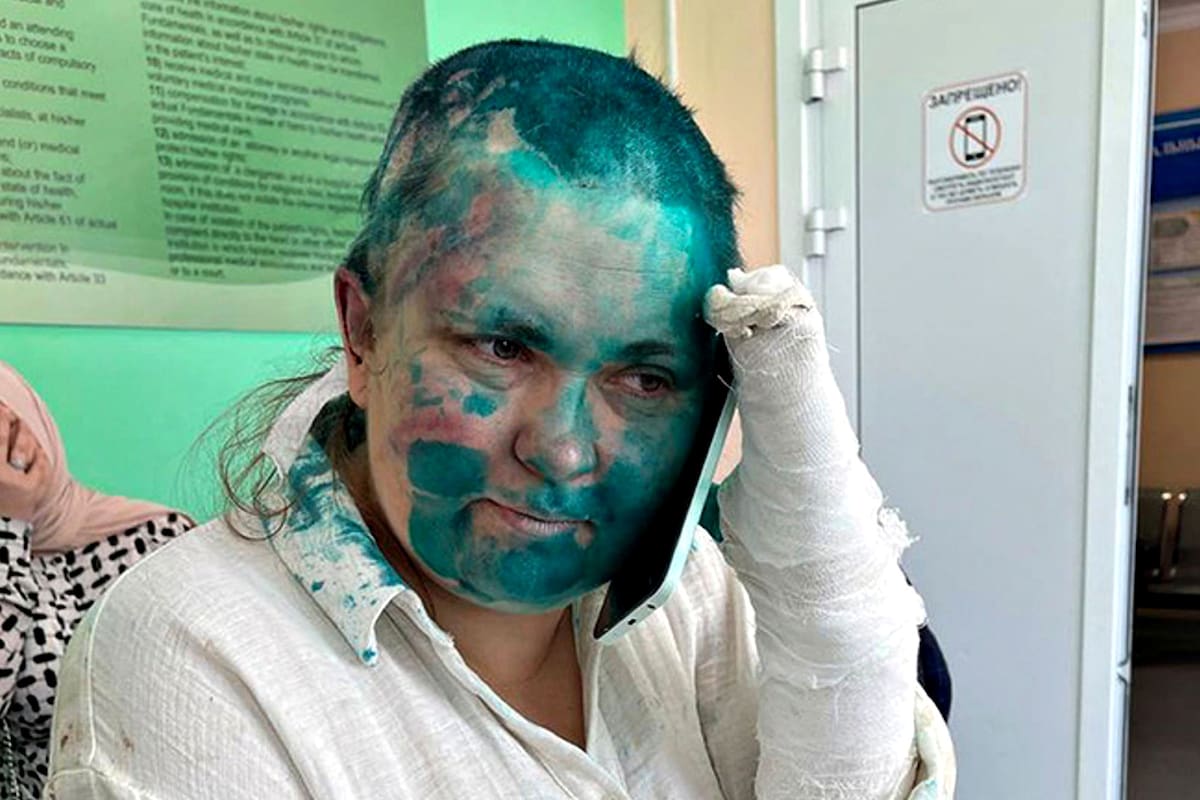 Yelena Milashina fue fotografiada con un antiséptico verde cubriendo su cara