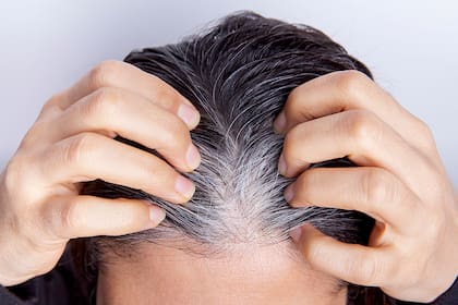 Las canas aparecen por el paso del tiempo o por el estrés