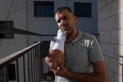 Yousef Adi, un palestino que dice haber sido golpeado por policías israelíes en Ramala, Cisjordania, el 11 de septiembre del 2022. (Foto AP/Nasser Nasser)