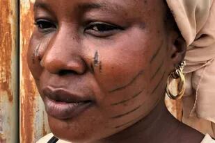 Cicatrices faciales: la violenta práctica a niños que es vista en África como símbolo de orgullo y belleza.