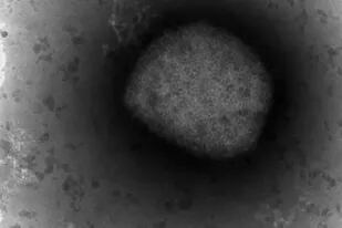 Esta foto provista por la Unidad de Microscopía Electrónica del ISCIII en Madrid, el 26 de mayo del 2002 muestra una imagen de microscopio electrónico del virus de viruela símica.  (Unidad de Microscopía Electrónica del ISCIII, via AP)